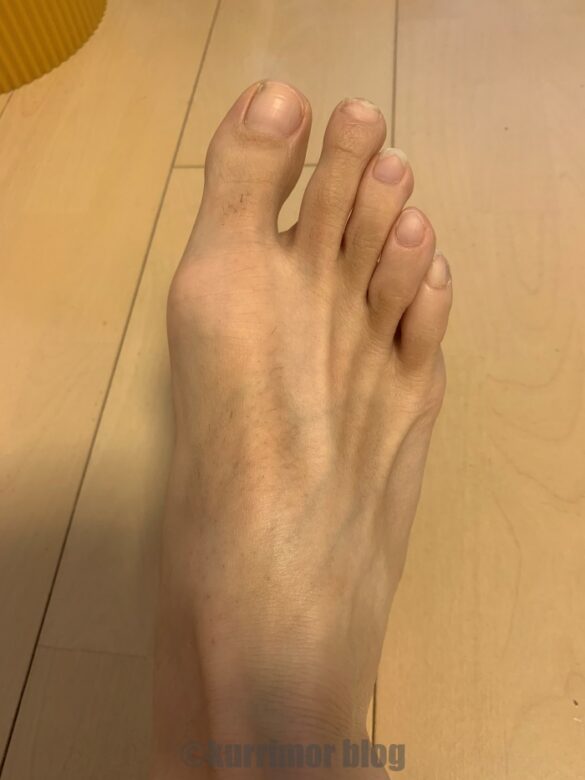 男の足の指の毛